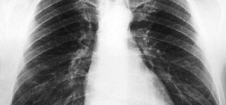 В Ярославской области проводится акция «Проверь себя»