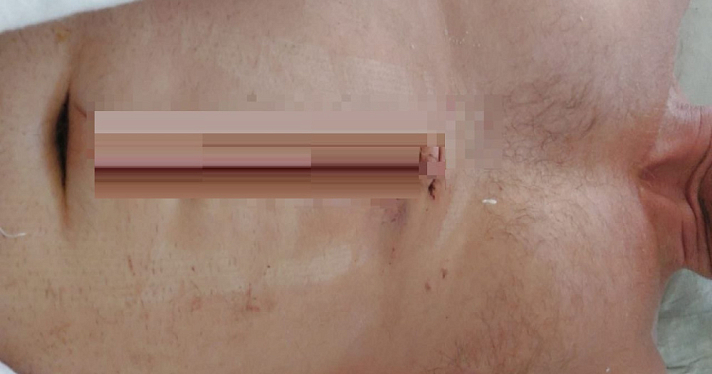 В Ярославской области вынесли приговор молодому человеку, напавшему с ножом на общественника