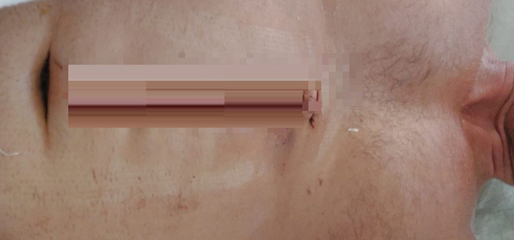 В Ярославской области вынесли приговор молодому человеку, напавшему с ножом на общественника