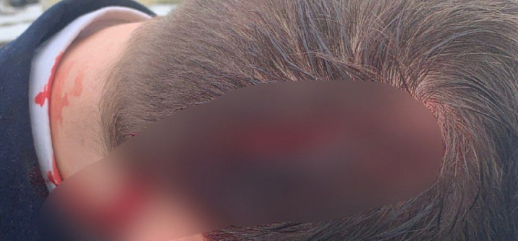 В Рыбинске упавшая глыба льда рассекла голову курсанту_267621